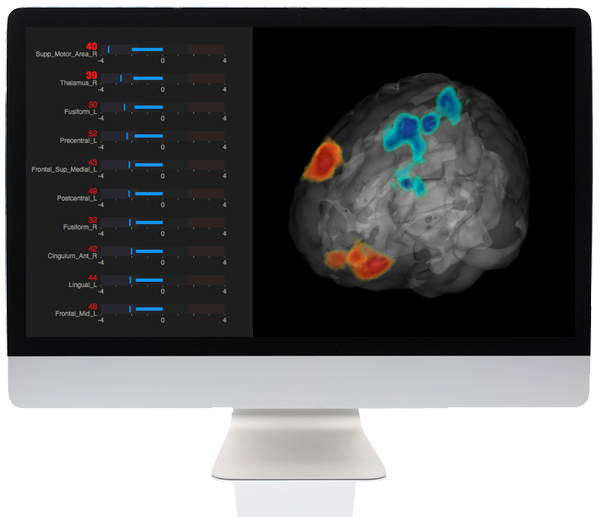 CereMetrix Silver Radiology AI Software